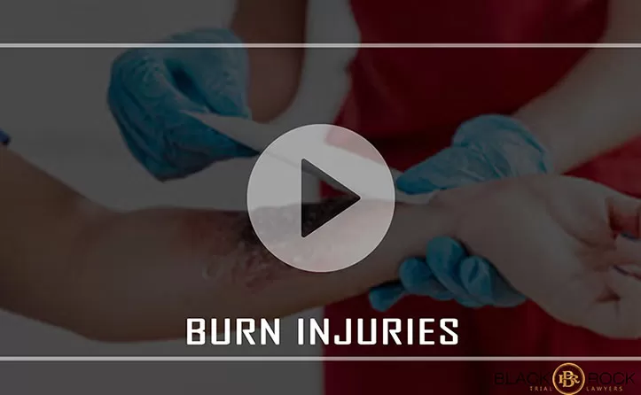 Burn Injuries | Black Rock Trial Layers /></noscript></a></div></div><h1 style=